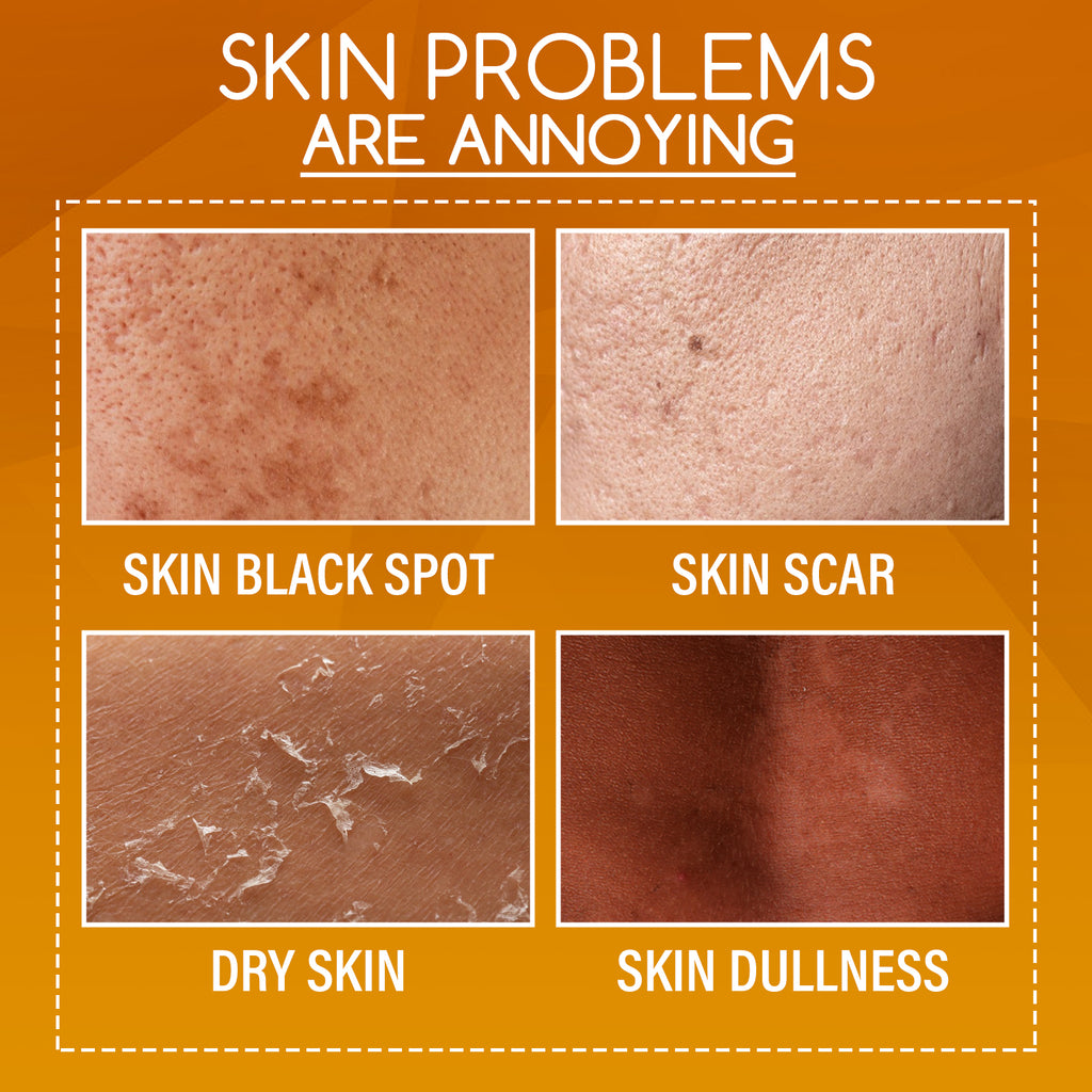 OUHOE Loción Corporal Exfoliante Aclarante con Cáscara de Naranja y Vitamina C