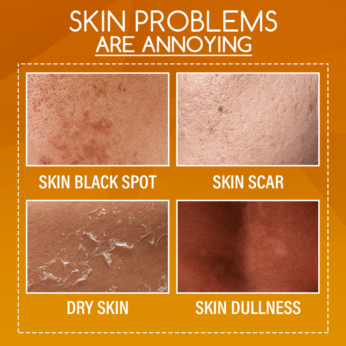 OUHOE Loción Corporal Exfoliante Aclarante con Cáscara de Naranja y Vitamina C