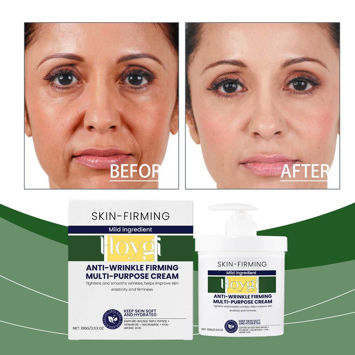 Crema Hidratante Facial | Nutre, Hidrata y Suaviza la Piel