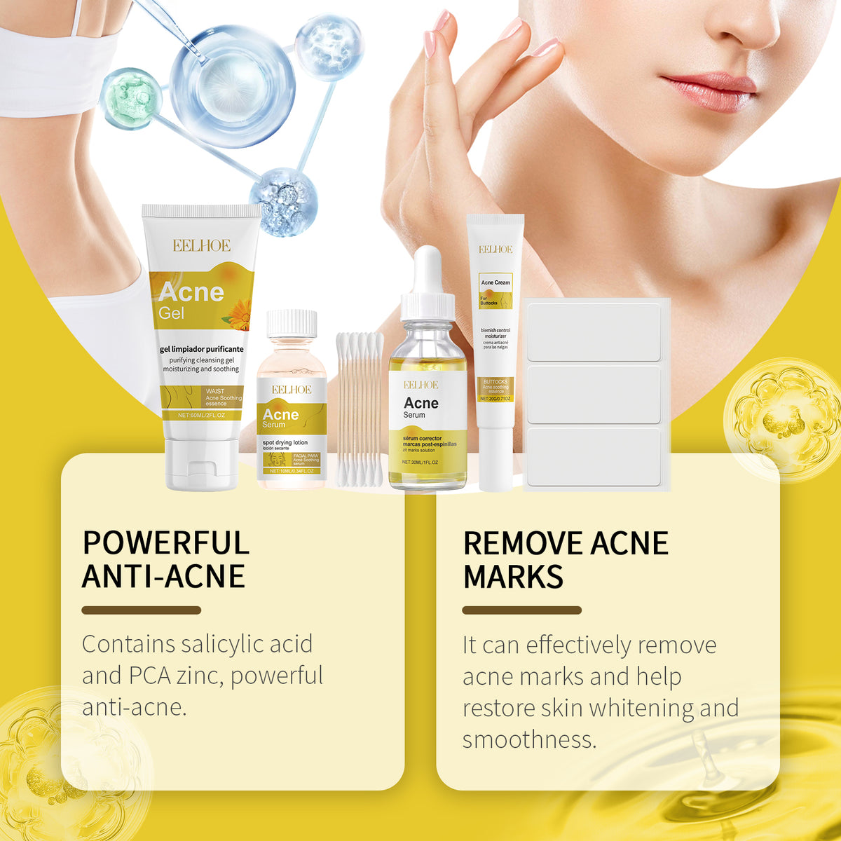 Set de Cuidado Facial Anti-Acné — Hidratación y Piel Suave